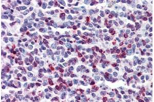 Human Tonsil: Formalin-Fixed, Paraffin-Embedded (FFPE) (DENND1B antibody  (AA 108-157))