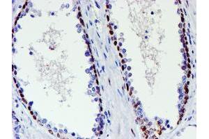 Image no. 2 for anti-WW Domain Containing Transcription Regulator 1 (WWTR1) antibody (ABIN1501763) (WWTR1 antibody)