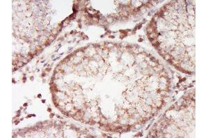 ABCA12 antibody  (AA 2051-2200)