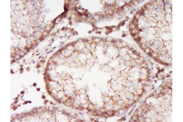 ABCA12 antibody  (AA 2051-2200)