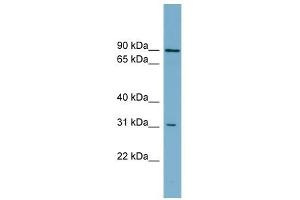 ABCD2 antibody used at 1 ug/ml to detect target protein.