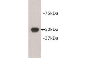 Western Blotting (WB) image for anti-FAT Tumor Suppressor Homolog 1 (FAT1) antibody (ABIN1854969) (FAT1 antibody)
