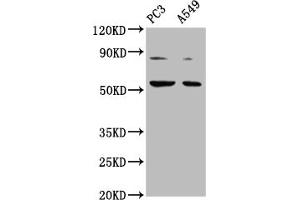 Western Blot Positive WB detected in: PC-3 whole cell lysate, A549 whole cell lysate All lanes: ARX antibody at 1:2000 Secondary Goat polyclonal to rabbit IgG at 1/50000 dilution Predicted band size: 59 kDa Observed band size: 59 kDa (Arx antibody  (AA 381-460))