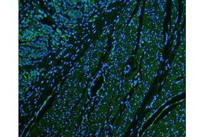 IF analysis of CD39/ENTPD1 using anti-CD39/ENTPD1 antibody (ABIN7602461). (CD39 antibody  (AA 79-411))