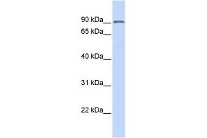 WB Suggested Anti-TRIM28 Antibody Titration: 0. (KAP1 antibody  (N-Term))