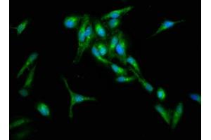 Immunofluorescence staining of Hela cells with ABIN7167114 at 1:133, counter-stained with DAPI. (RIN1 antibody  (AA 192-341))