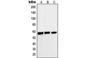 Western blot analysis of c-Myc (pS62) expression in A431 (A), HeLa (B), Jurkat (C) whole cell lysates. (c-MYC antibody  (N-Term, pSer62))