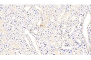 Detection of CYPB in Human Kidney Tissue using Monoclonal Antibody to Cyclophilin B (CYPB) (PPIB antibody  (AA 47-216))