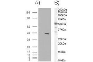 Image no. 1 for anti-SWI/SNF Related, Matrix Associated, Actin Dependent Regulator of Chromatin, Subfamily E, Member 1 (SMARCE1) (C-Term) antibody (ABIN374349) (SMARCE1 antibody  (C-Term))