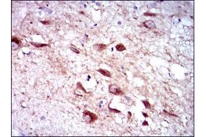Immunohistochemical analysis of paraffin-embedded human brain tissues using CYP3A4 mouse mAb with DAB staining. (CYP3A4 antibody)