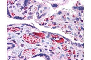 Immunohistochemistry (IHC) image for anti-Arginase, Liver (ARG1) (N-Term) antibody (ABIN2782309) (Liver Arginase antibody  (N-Term))