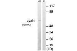 Western blot analysis of extracts from Jurkat cells treated with paclitaxel 1uM 24h, using Zyxin (Phospho-Ser142) Antibody. (ZYX antibody  (pSer142))
