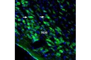 Expression of Homer3 in rat nucleus basalis - Immunohistochemical staining of perfusion-fixed frozen rat brain sections with Anti-Homer3 Antibody (ABIN7043275, ABIN7045172 and ABIN7045173), (1:1000), followed by goat anti-rabbit-AlexaFluor-488. (HOMER3 antibody  (Intracellular))