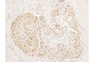 Immunohistochemistry (IHC) image for anti-Stromal Antigen 1 (STAG1) (AA 25-75) antibody (ABIN7453936)
