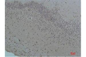 Immunohistochemistry (IHC) analysis of paraffin-embedded Rat Brain Tissue using Bestrophin-1 Rabbit Polyclonal Antibody diluted at 1:200. (Bestrophin 1 antibody)
