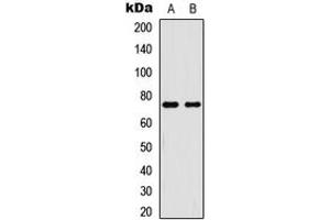 Western blot analysis of NF-kappaB p65 (pT254) expression in HeLa TNFa-treated (A), HL60 TNFa-treated (B) whole cell lysates. (NF-kB p65 antibody  (pSer254))