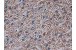 Immunohistochemistry (IHC) image for anti-Transmembrane Protease, serine 4 (TMPRSS4) (AA 54-437) antibody (ABIN7436138)