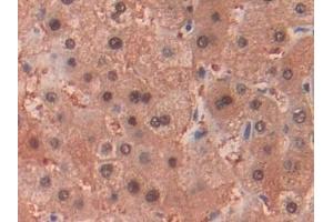 Immunohistochemistry (IHC) image for anti-Alcohol Dehydrogenase 1 (Class I) (ADH1) (AA 169-370) antibody (ABIN7432379)