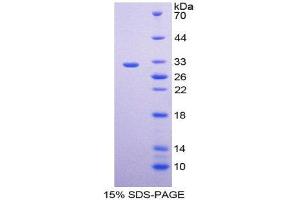 SDS-PAGE (SDS) image for Endothelin-Converting Enzyme 1 (ECE1) (AA 214-448) protein (His tag) (ABIN2124725)