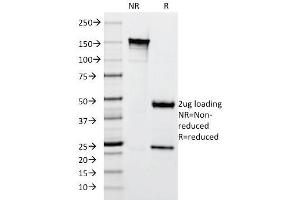 SDS-PAGE Analysis Purified Cytokeratin 10 Mouse Monoclonal Antibody (SPM261). (Keratin 10 antibody)