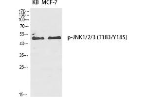 Western Blot analysis of KB (1), MCF-7 (2), diluted at 1:2000. (JNK antibody  (pThr183))