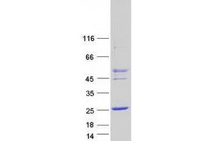 Validation with Western Blot (CTAG2 Protein (Transcript Variant 1) (Myc-DYKDDDDK Tag))
