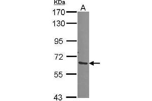 WB Image Sample (30 ug of whole cell lysate) A: A549 7. (Proteasome 26S S3 (Center) antibody)