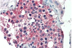 Human Testis (formalin-fixed, paraffin-embedded) stained with ALDH1A1 antibody ABIN337223 at 2. (ALDH1A1 antibody  (AA 476-488))