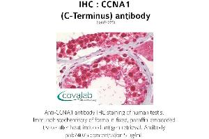 Image no. 1 for anti-Cyclin A1 (CCNA1) antibody (ABIN1732738) (Cyclin A1 antibody)