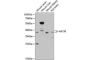 Western blot analysis of extracts of various cell lines, using MC3R antibody (ABIN6128220, ABIN6143613, ABIN6143616 and ABIN6215298) at 1:3000 dilution. (MC3R antibody  (AA 1-120))