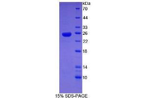SDS-PAGE analysis of Human SHBG Protein. (SHBG Protein)