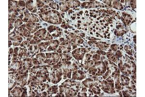 Image no. 5 for anti-THUMP Domain Containing 1 (THUMPD1) antibody (ABIN1501384) (THUMPD1 antibody)