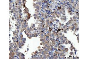 IHC analysis of MSF/SEPTIN9 using anti-MSF/SEPTIN9 antibody (ABIN7600104). (Septin 9 antibody  (AA 15-282))