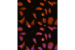 Immunofluorescence analysis of L929 cells using GST3/GST3/GSTP1 Rabbit pAb (ABIN6131722, ABIN6141480, ABIN6141481 and ABIN6221347) at dilution of 1:100 (40x lens). (GSTP1 antibody  (AA 1-210))