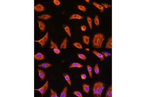 Immunofluorescence analysis of L929 cells using GST3/GST3/GSTP1 Rabbit pAb (ABIN6131722, ABIN6141480, ABIN6141481 and ABIN6221347) at dilution of 1:100 (40x lens). (GSTP1 antibody  (AA 1-210))