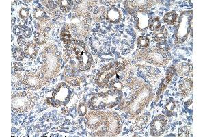 UST antibody was used for immunohistochemistry at a concentration of 4-8 ug/ml. (UST antibody  (C-Term))