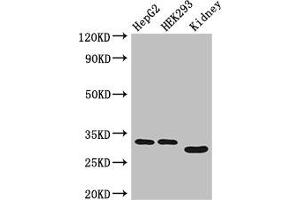 Western Blot Positive WB detected in: HepG2 whole cell lysate, HEK293 whole cell lysate, Mouse kidney tissue All lanes: GEMIN8 antibody at 4 μg/mL Secondary Goat polyclonal to rabbit IgG at 1/50000 dilution Predicted band size: 29 kDa Observed band size: 29, 33 kDa (GEMIN8 antibody  (AA 1-242))