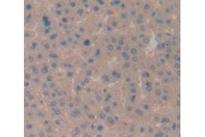 IHC-P analysis of Rat Tissue, with DAB staining. (CD3D antibody  (AA 22-106))