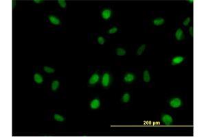 Immunofluorescence of monoclonal antibody to SURB7 on HeLa cell. (MED21 antibody  (AA 1-144))