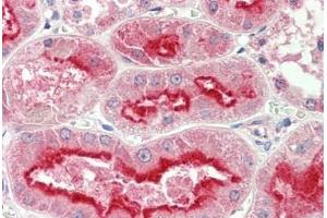 Human Kidney: Formalin-Fixed, Paraffin-Embedded (FFPE) (APMAP antibody  (AA 74-123))