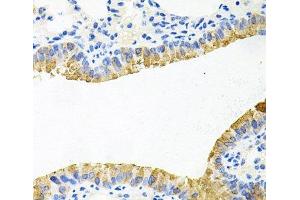 Immunohistochemistry of paraffin-embedded Mouse lung using TOB2 Polyclonal Antibody at dilution of 1:100 (40x lens). (TOB2 antibody)