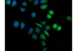 Immunofluorescence staining of A549 cells with ABIN7143677 at 1:120,counter-stained with DAPI. (ALDH3A1 antibody  (AA 210-453))
