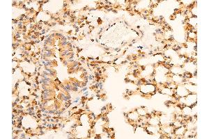 Immunohistochemistry (IHC) image for anti-Nuclear Factor of kappa Light Polypeptide Gene Enhancer in B-Cells Inhibitor, alpha (NFKBIA) (pSer32), (pSer36) antibody (ABIN6256292)