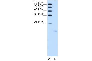 WB Suggested Anti-ACP1  Antibody Titration: 1. (ACP1 antibody  (N-Term))