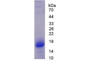 Image no. 1 for VAMP (Vesicle-Associated Membrane Protein)-Associated Protein A, 33kDa (VAPA) (AA 1-249) protein (His tag) (ABIN1081163)