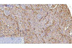 Immunohistochemistry of paraffin-embedded Rat kidney tissue using MAP1LC3A Monoclonal Antibody at dilution of 1:200. (MAP1LC3A antibody)