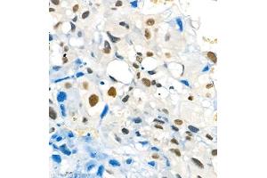 Immunohistochemistry of paraffin embedded rat placenta using Skar (ABIN7074970) at dilution of 1:1800 (400x lens) (p46 antibody)