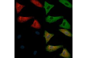 ABIN6261536 and ABIN6266485 staining  cells(H2O2 treatment) by IF/ICC.