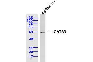 Mouse epithelium lysates probed with GATA3 Polyclonal Antibody, Unconjugated  at 1:300 dilution and 4˚C overnight incubation.