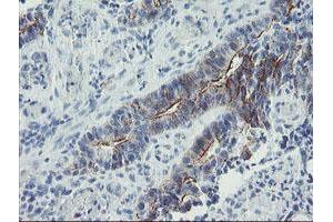 Image no. 1 for anti-Zinc Finger Protein 365 (ZNF365) (AA 108-407) antibody (ABIN1490828)